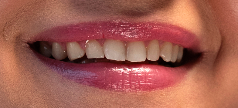 Sorriso representando tamanho