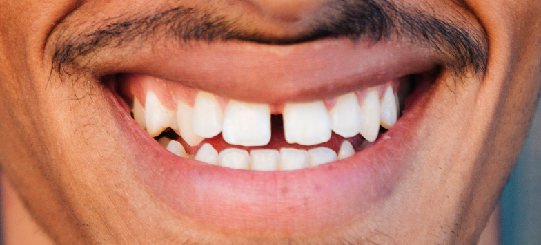 Sorriso representando espaços